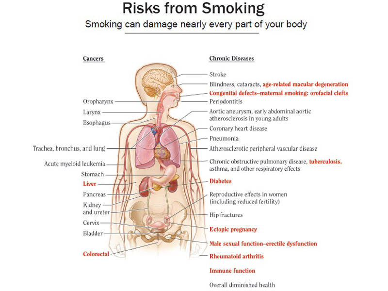 Compassionate-Care-at-Durdans-Hospital-for-Health-Conditions-Caused-by-Tobacco-Use